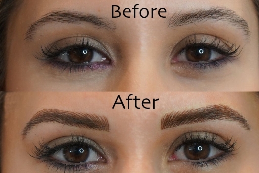 3D Kıl Tekniği Mikropigmentasyon Uygulaması